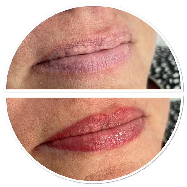 Semi Permanent Lips Blush before and after at Precision Beauty Worthing