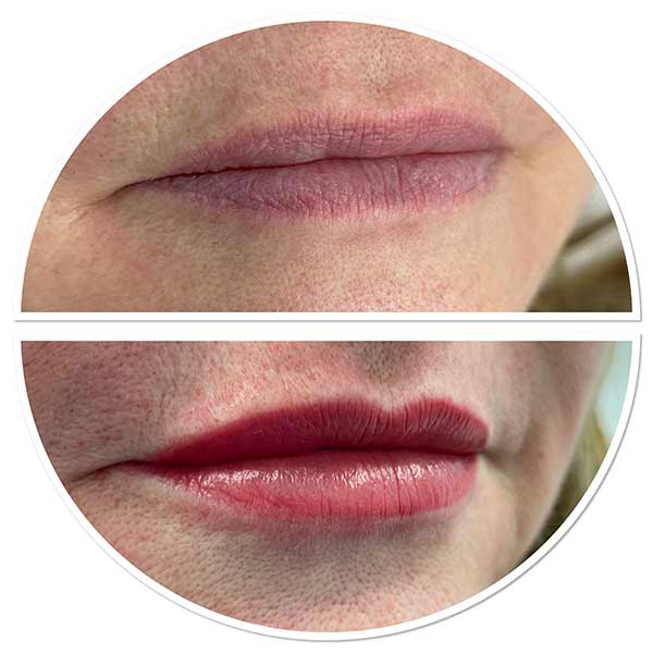 Lip Blush before and after at Precision Beauty Worthing